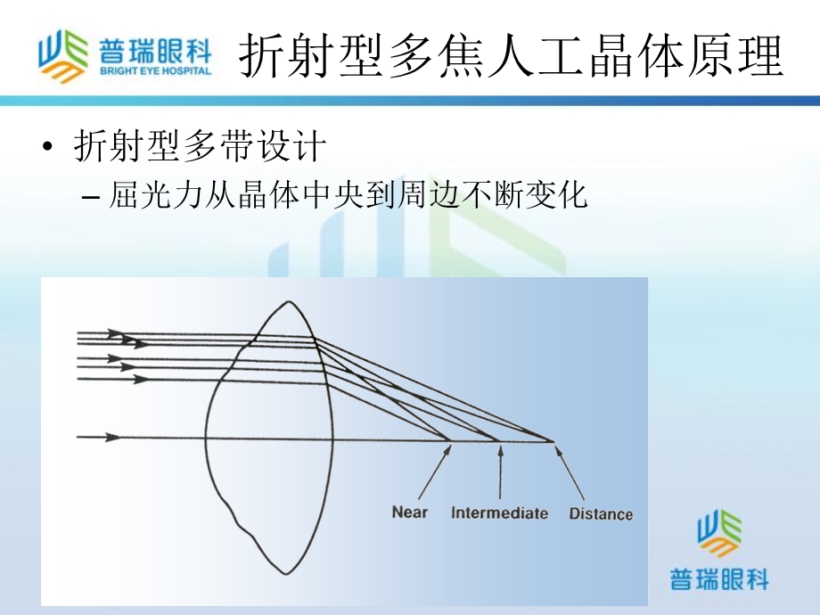 ECNIS多焦点人工晶体ZMA.ppt_第2页