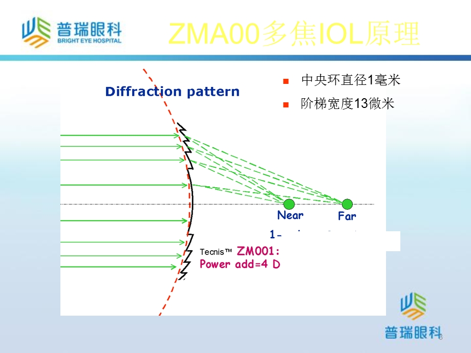 ECNIS多焦点人工晶体ZMA.ppt_第3页