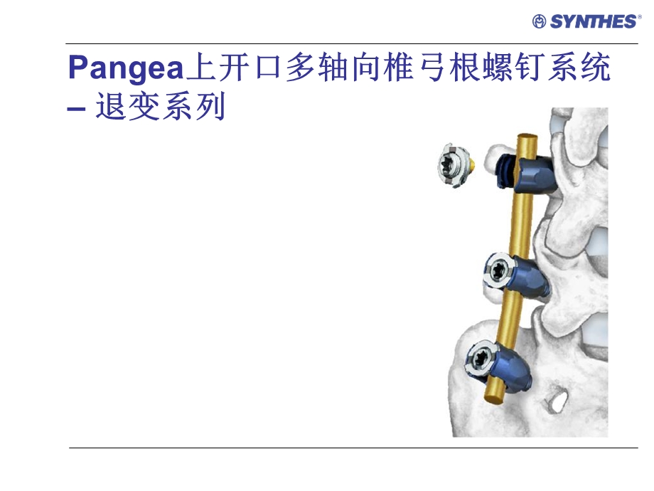 angea上开口多轴向椎弓根螺钉产品介绍.ppt_第1页