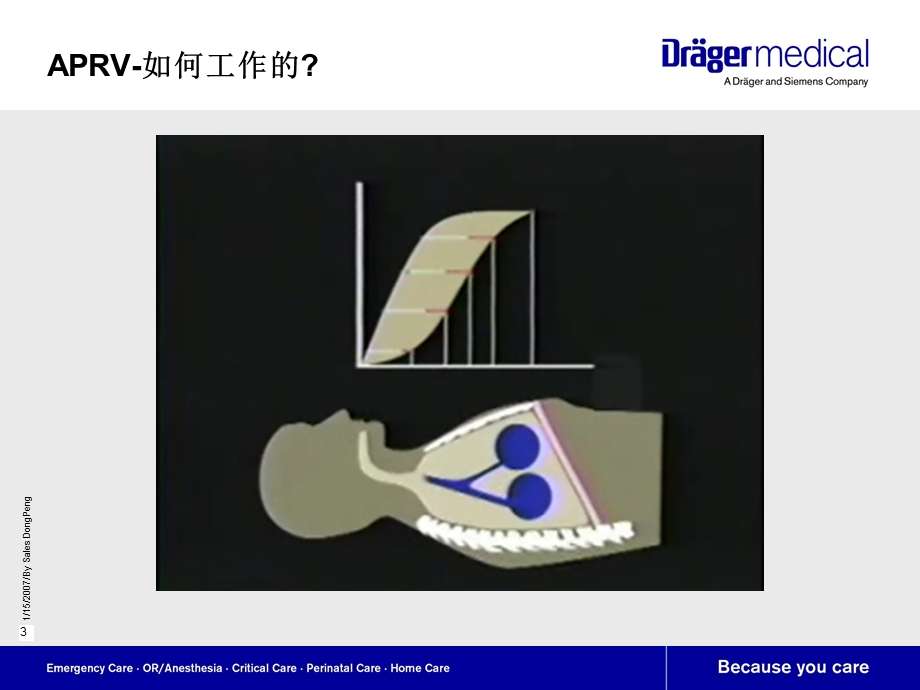 APRV气道压力释放通气.ppt_第3页