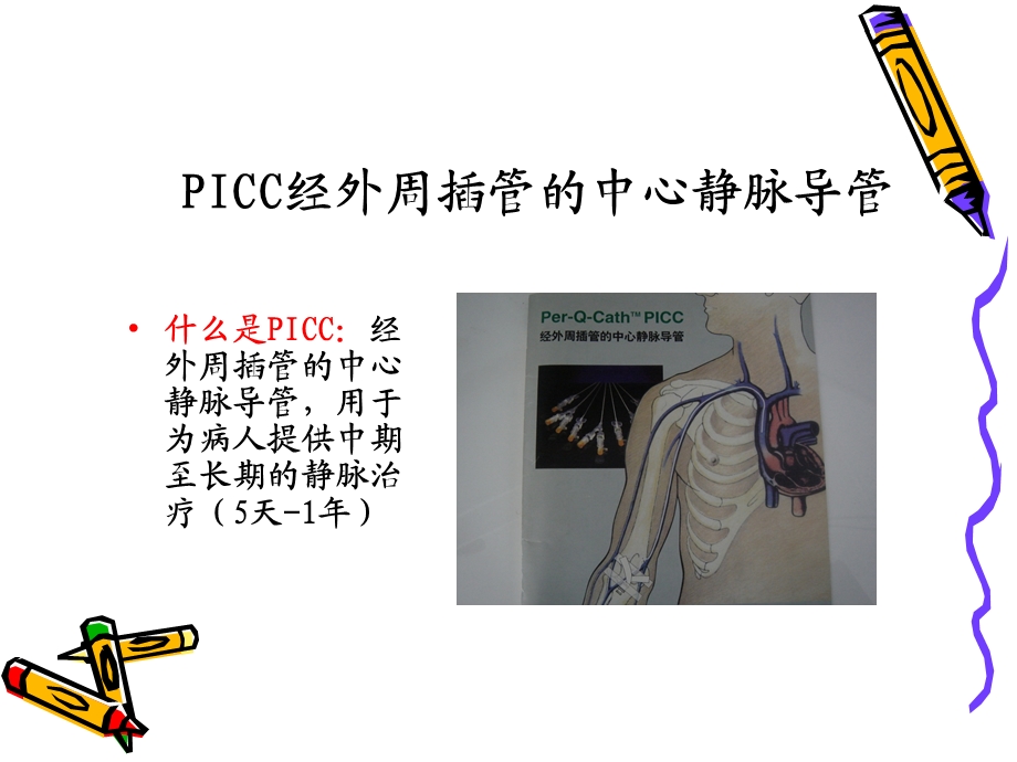 PICC置管置管前评估.ppt_第2页