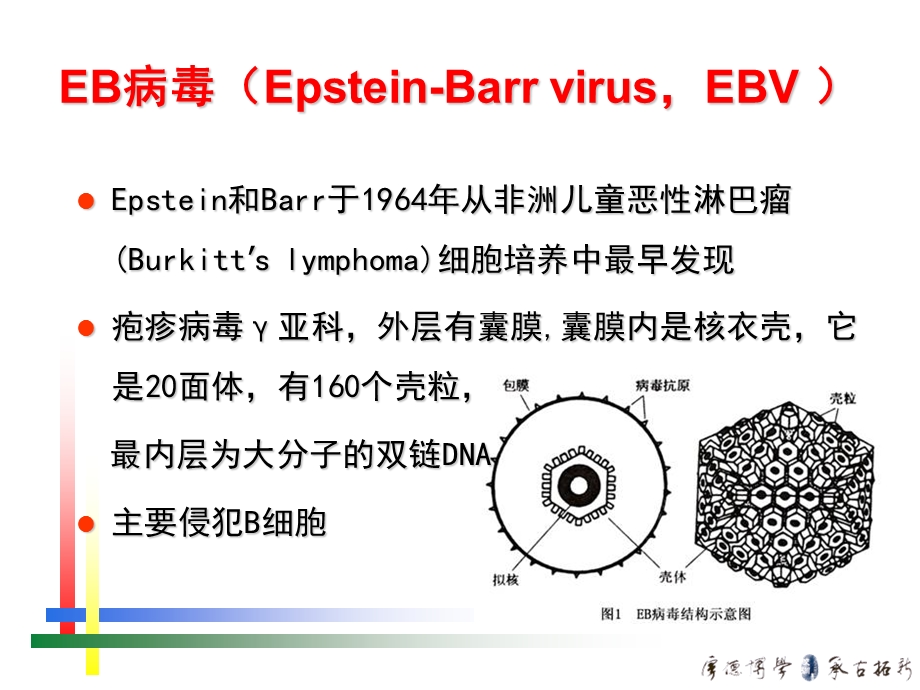 EB病毒感染的特殊表现.ppt_第2页