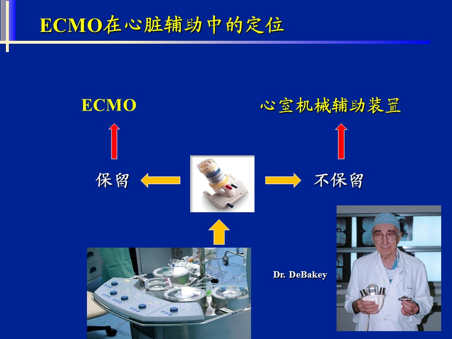 ECMO在心脏辅助中的应用.ppt_第2页