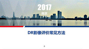 DR影像评价常见方法.ppt