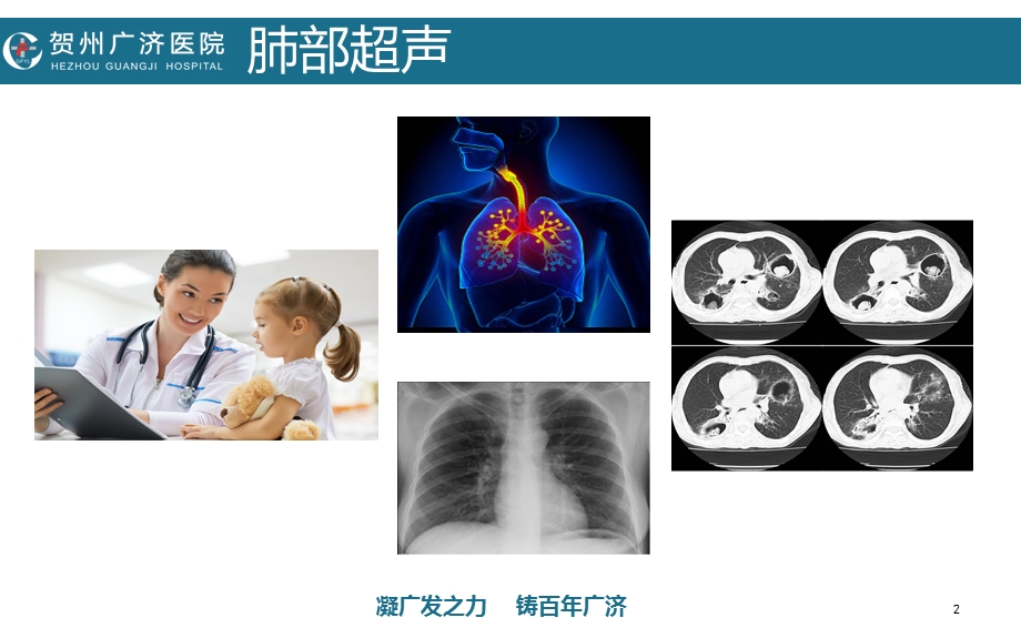 ICU肺部超声基础.ppt_第2页