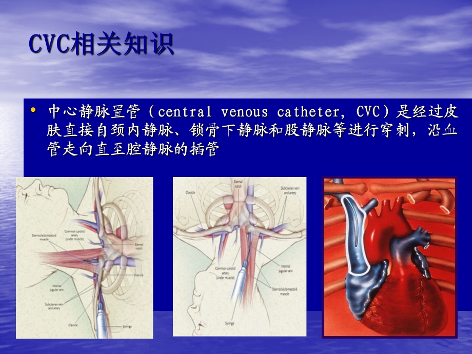 2013院内静疗专科护士培训班第一期第一课.ppt_第2页