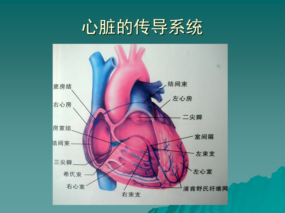 ICU常见心律失常.ppt_第3页