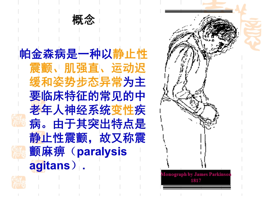 《帕金森氏病的护理》PPT课件.ppt_第3页