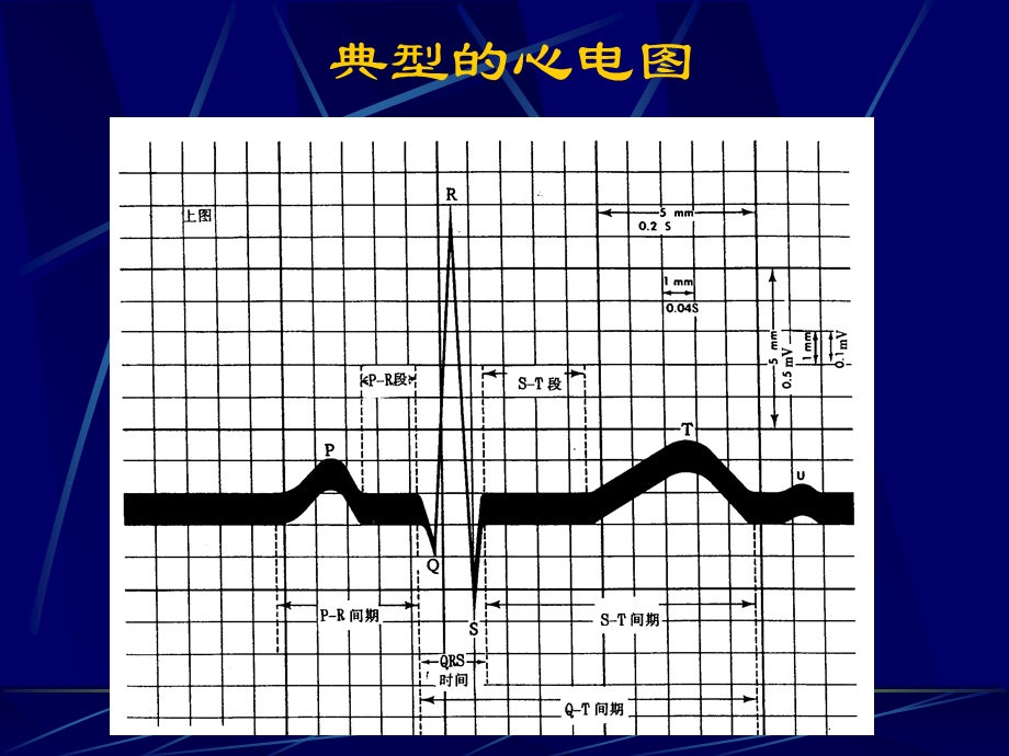 《小儿心电图》PPT课件.ppt_第3页