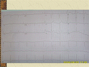 《心电图正常值》PPT课件.ppt