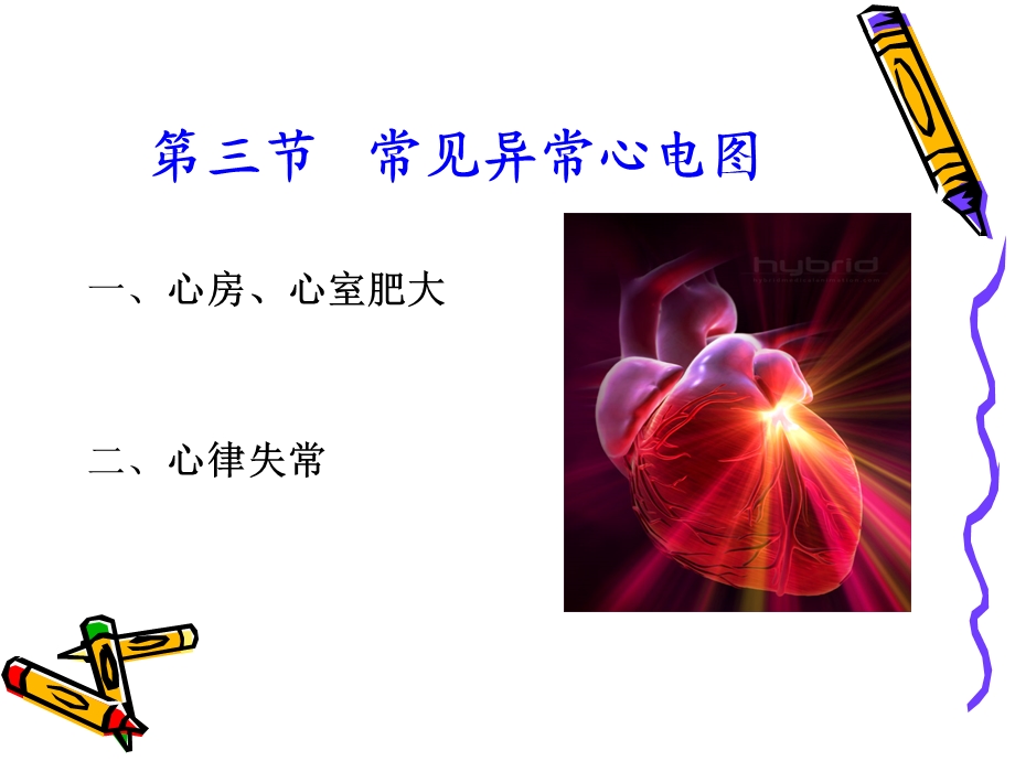 《常见异常心电图》PPT课件.ppt_第2页