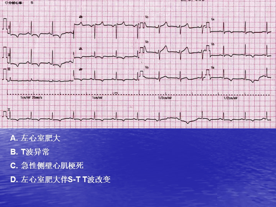 心电图考试练习.ppt_第2页