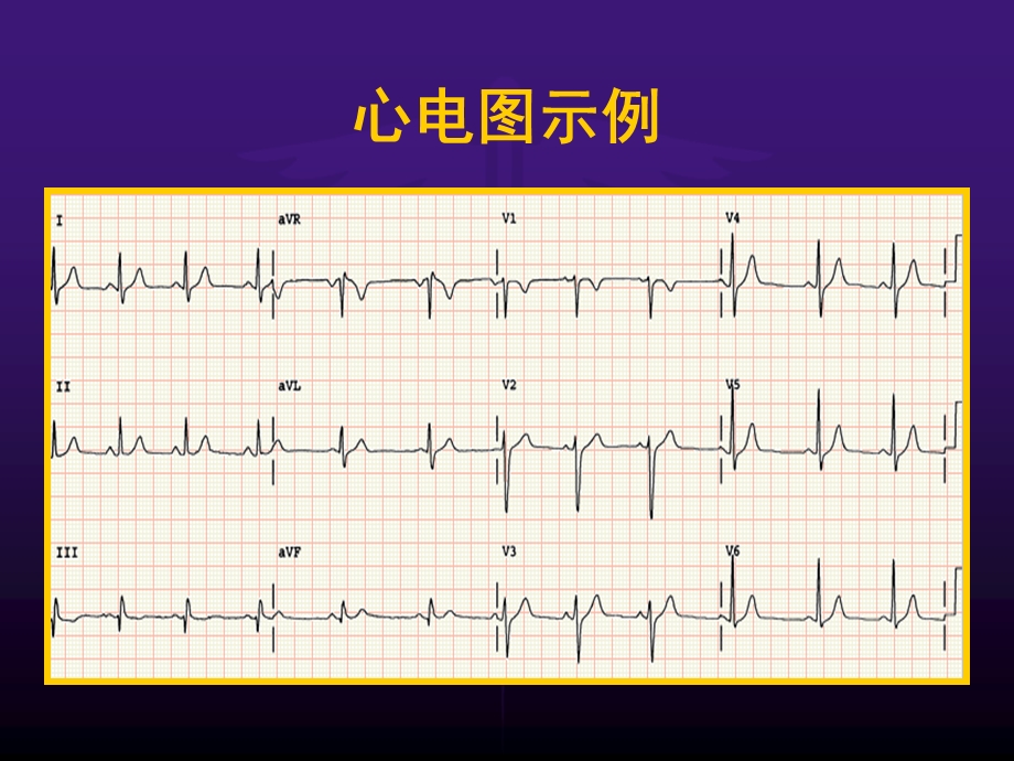 《心电图学上》PPT课件.ppt_第3页