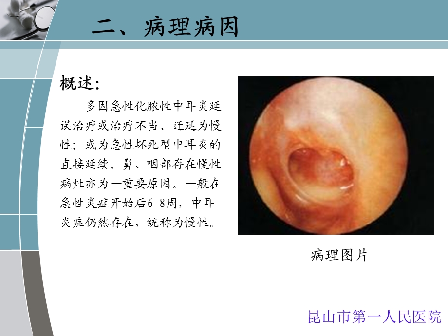 《慢性化脓性中耳炎》PPT课件.ppt_第3页