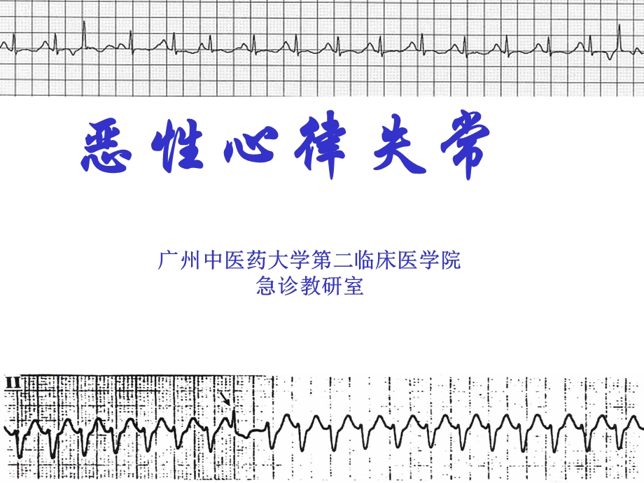 《恶性心律失常》PPT课件.ppt_第1页