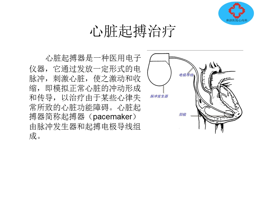 《心脏起搏治疗》PPT课件.ppt_第1页