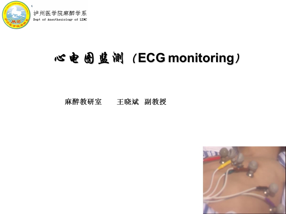 《心电图监测》PPT课件.ppt_第1页