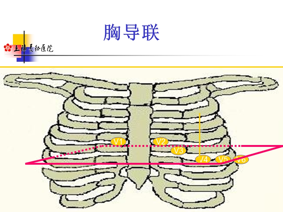 《心电图规培生》PPT课件.ppt_第3页