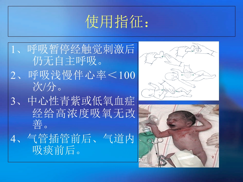 《复苏囊的使用》PPT课件.ppt_第3页