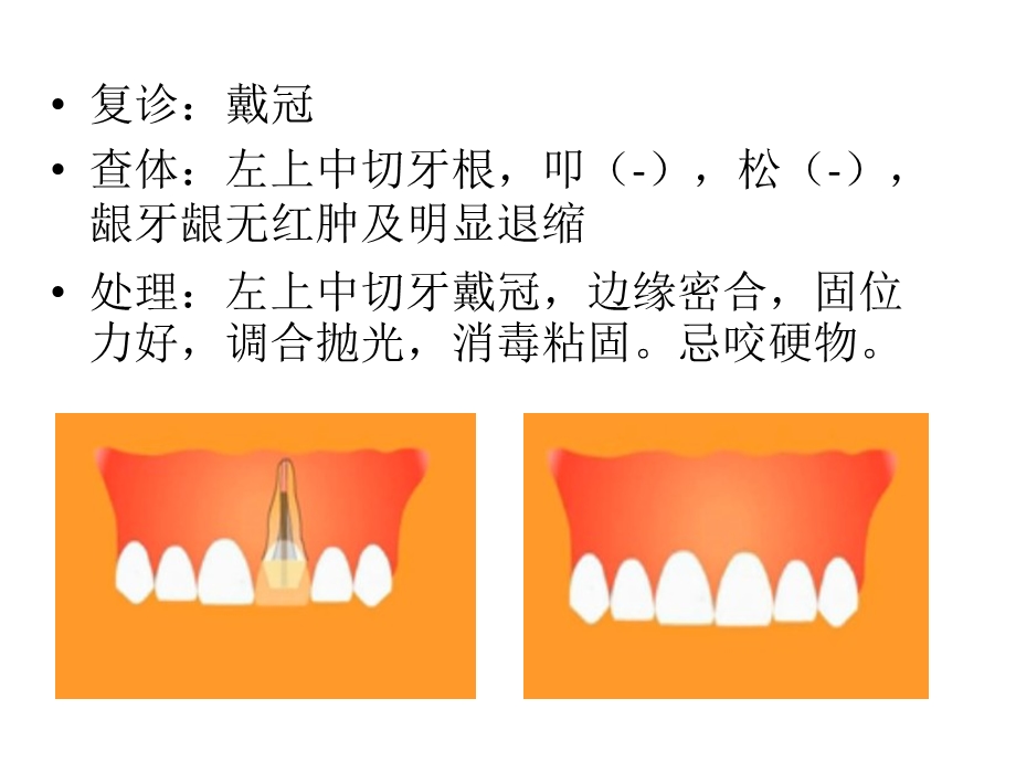 《口腔修复病例》PPT课件.ppt_第3页