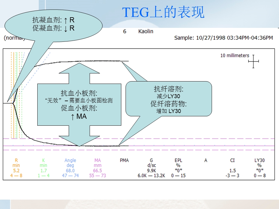 《凝血药物知识》PPT课件.ppt_第3页