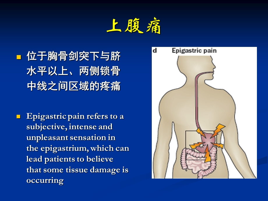 《功能消化不良》PPT课件.ppt_第3页