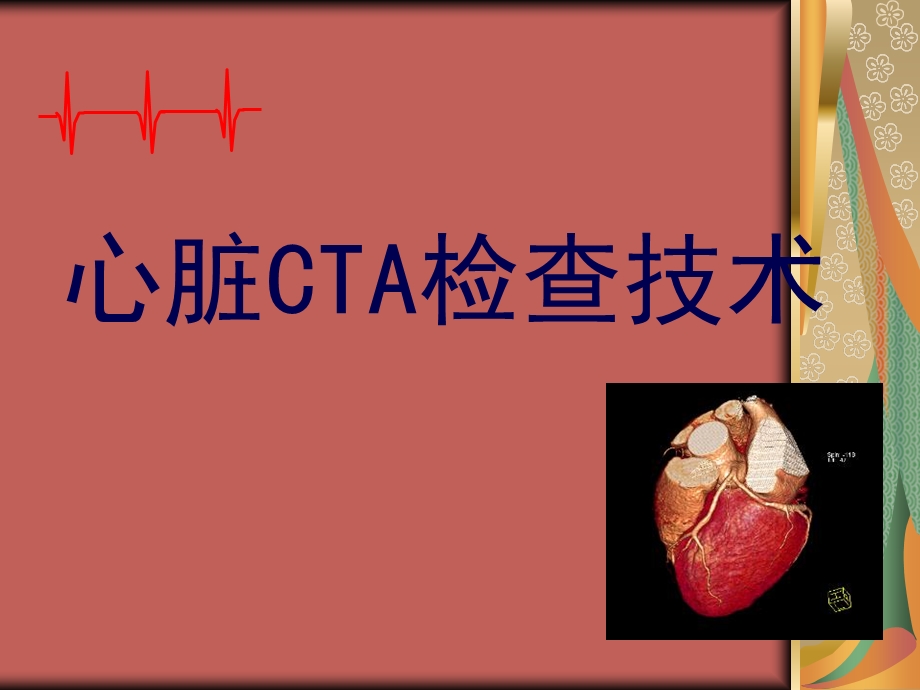 《心脏cta检查》PPT课件.ppt_第1页