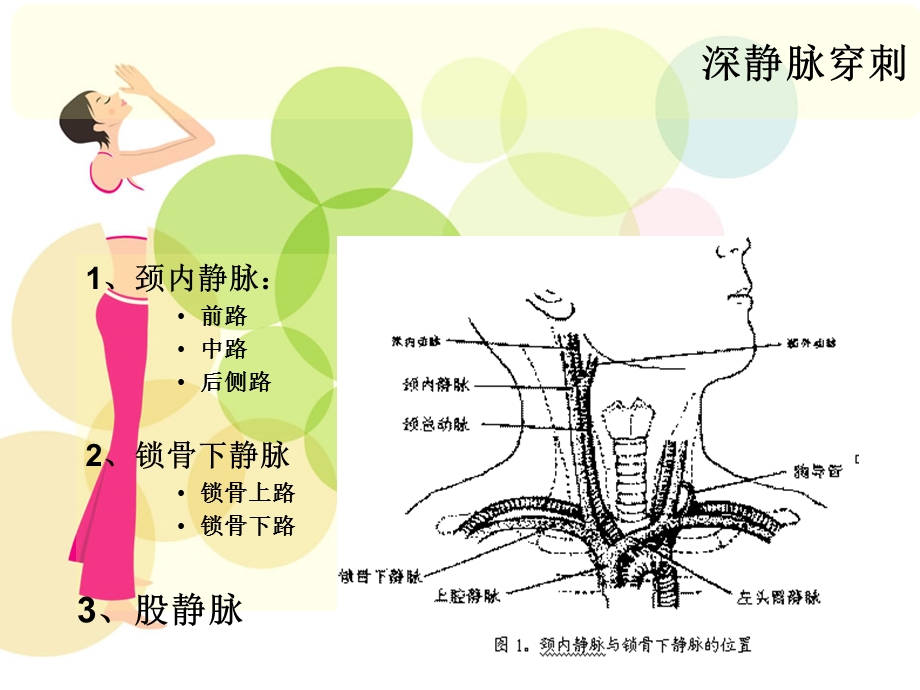 中心静脉压(CVP)监测888.ppt_第3页