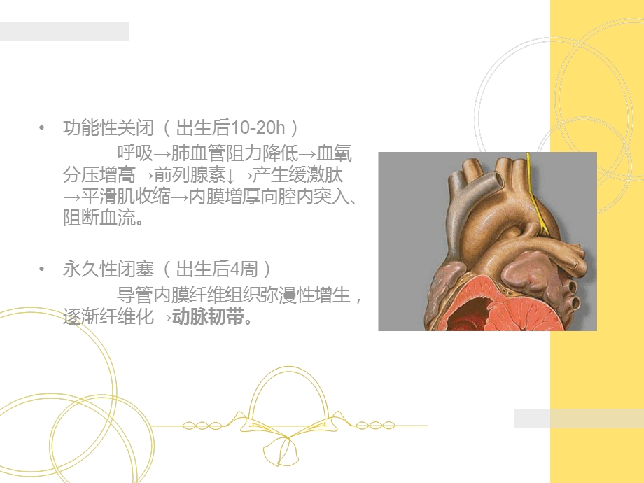 《动脉导管未闭》PPT课件.ppt_第3页