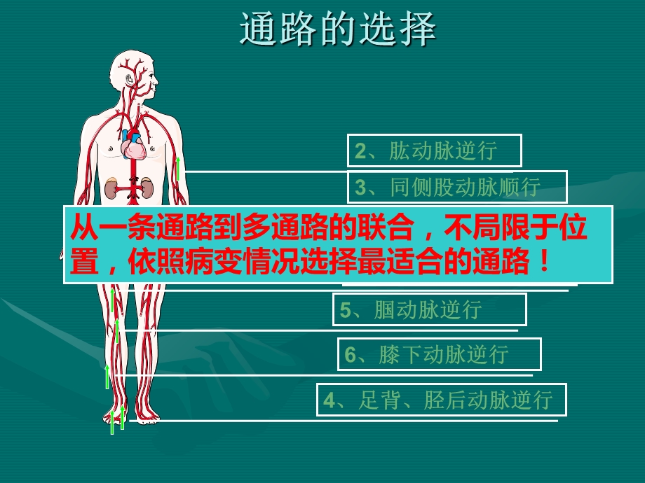 《下肢动脉穿刺》PPT课件.ppt_第2页