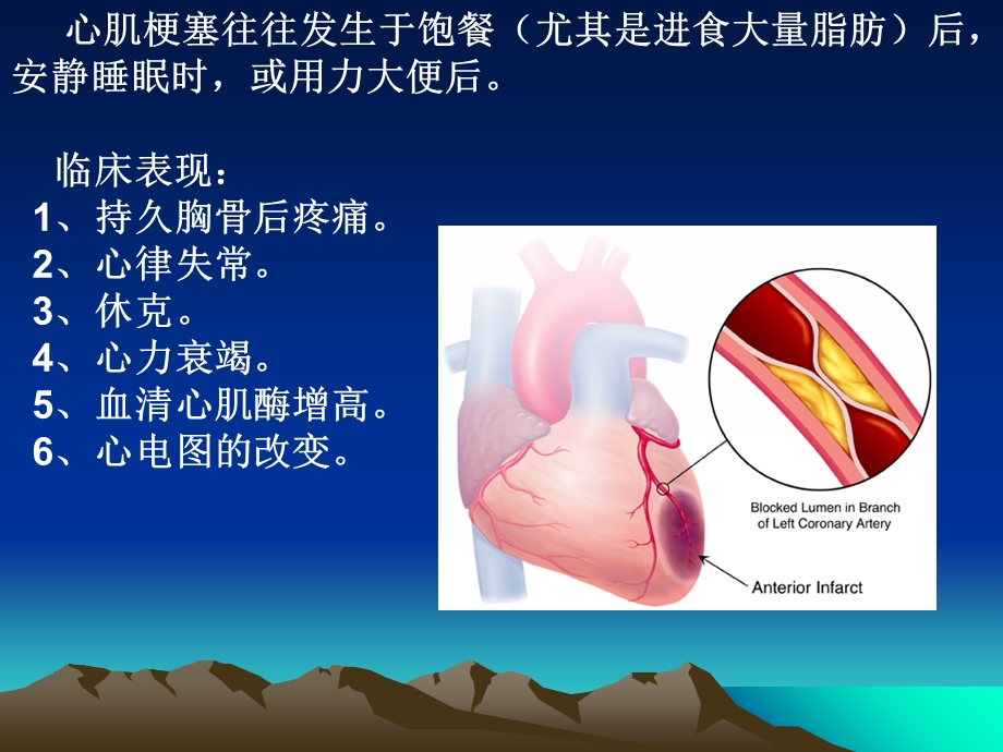 《急性心肌梗死》PPT课件.ppt_第2页