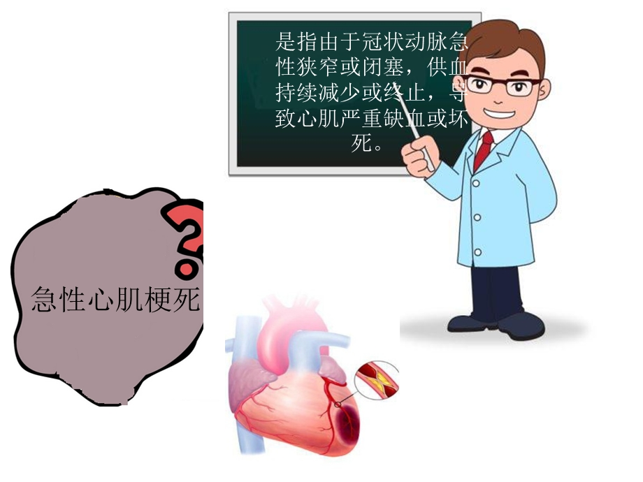 《急性心梗教学》PPT课件.ppt_第3页