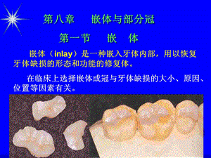 《嵌体与部分冠》PPT课件.ppt