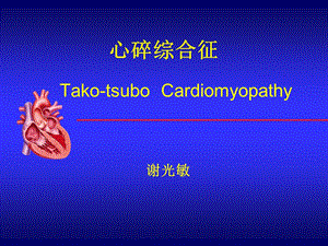 《心碎综合征》PPT课件.ppt