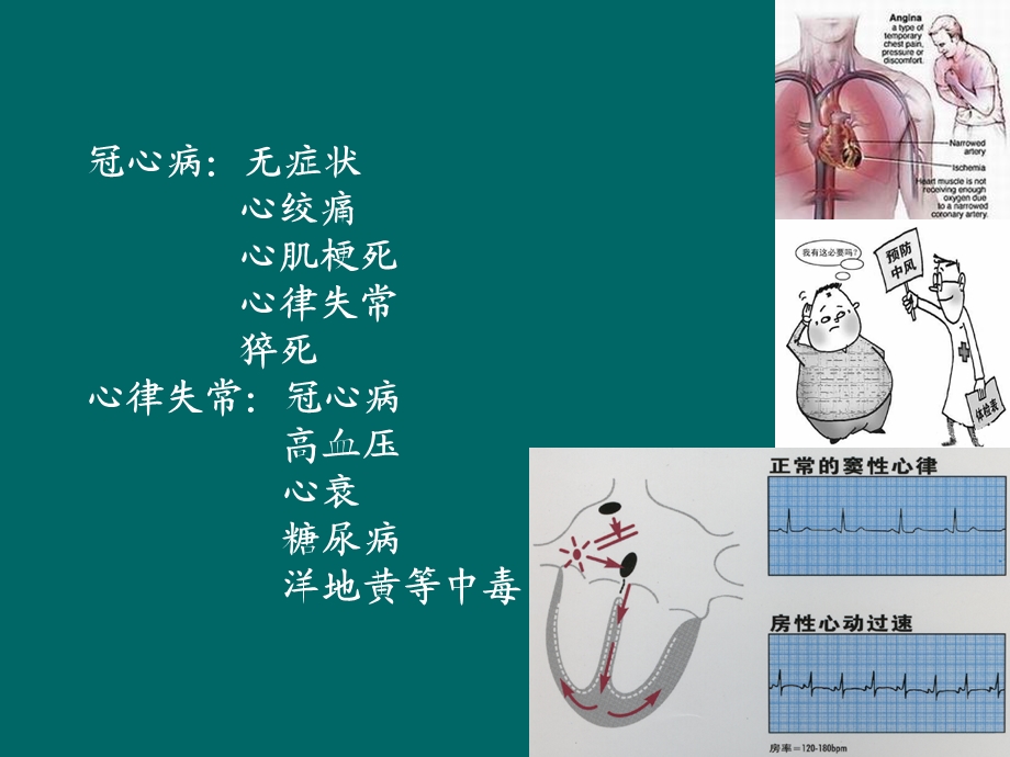 《心律失常食疗》PPT课件.ppt_第1页