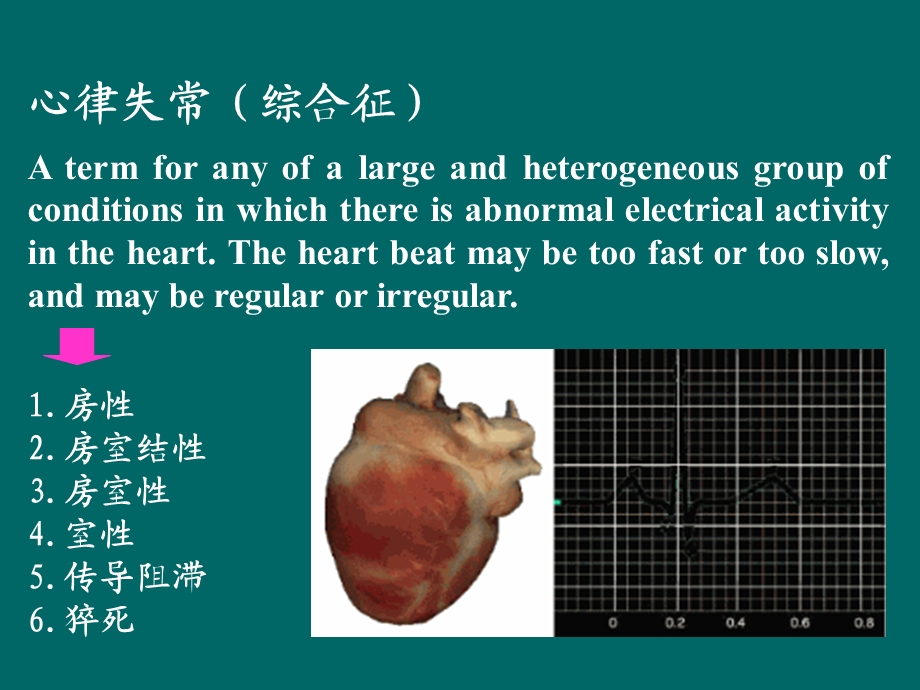 《心律失常食疗》PPT课件.ppt_第3页