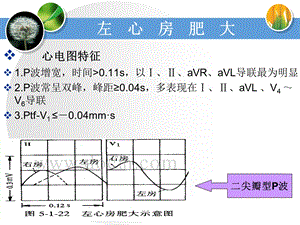 《左心房肥大》PPT课件.ppt