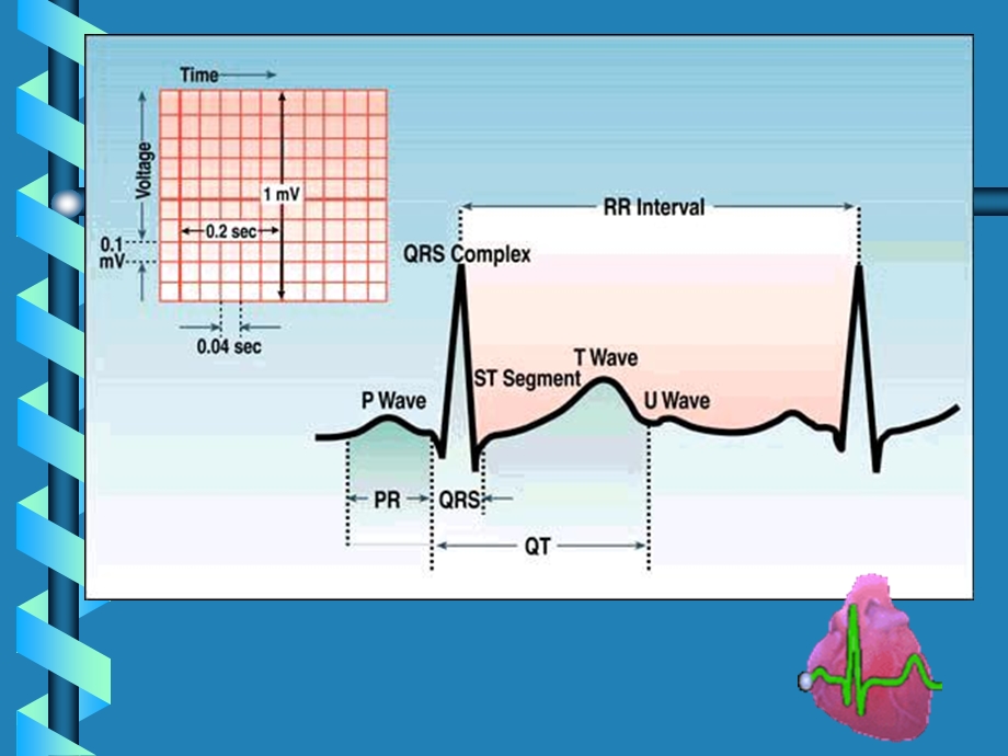 《心电图分析》PPT课件.ppt_第3页