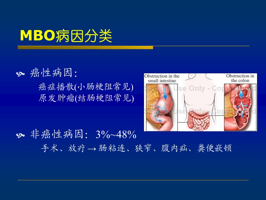 《恶性肠梗阻》PPT课件.ppt_第3页