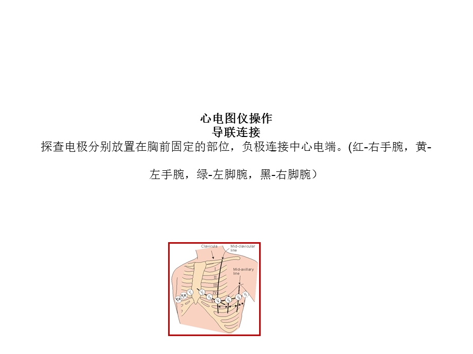 《心电图仪操作》PPT课件.ppt_第1页