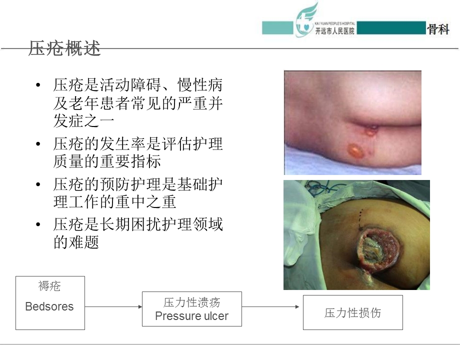 《压疮新分期》PPT课件.ppt_第3页