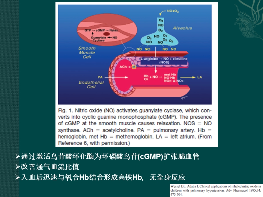 一氧化氮吸入在新生儿中应用.ppt_第3页