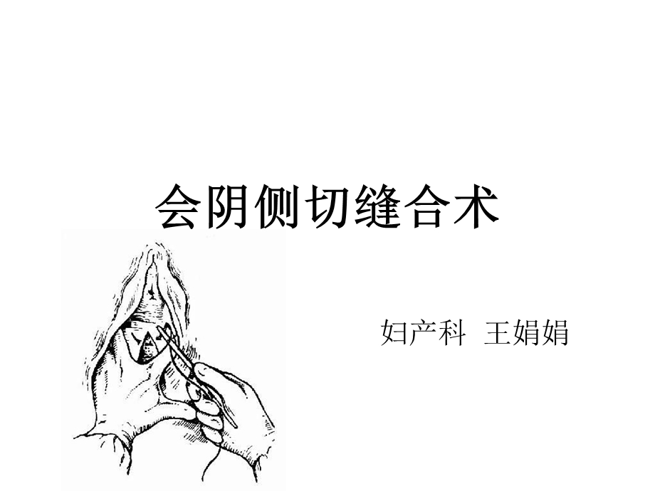 《会阴侧切缝合术》PPT课件.ppt_第1页