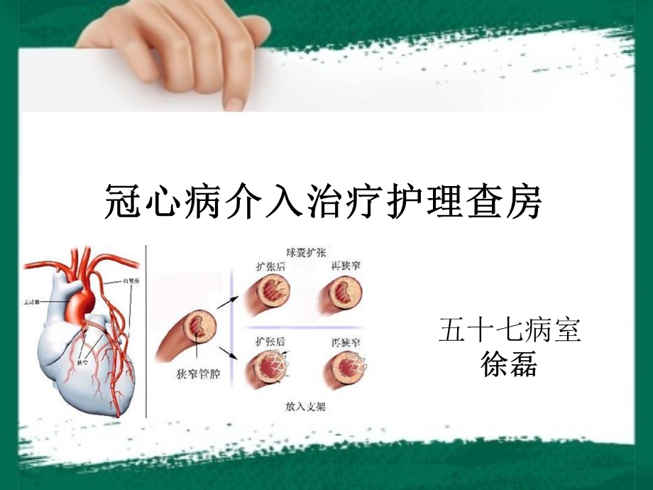 《冠心病查房》PPT课件.ppt_第1页