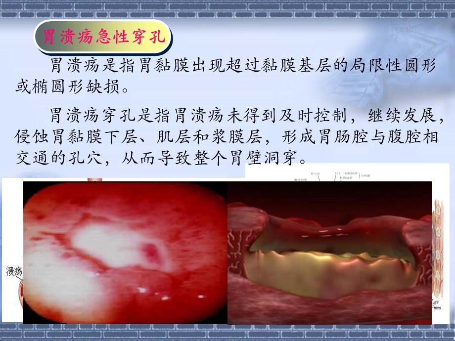 《局解病例分析》PPT课件.ppt_第2页