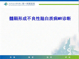 髓鞘形成不良性脑白质病.ppt