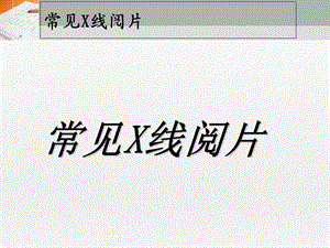 《常见X线读片》PPT课件.ppt