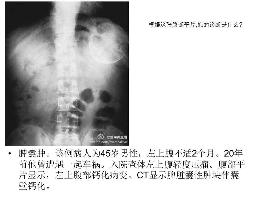 医学微直播.ppt_第3页