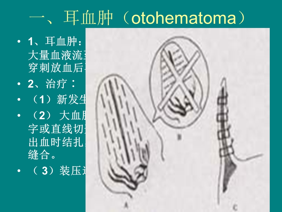 《各部外科病》PPT课件.ppt_第2页