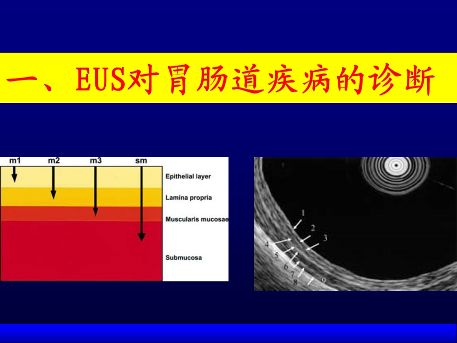 EUS诊断技术现状.ppt_第2页